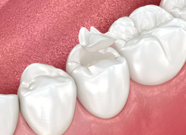 Best Cosmetic Dentistry  in Peotone, IL